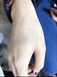 -天道专业洗纹身