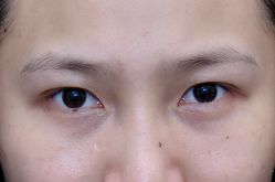 -深圳艺星医疗美容医院