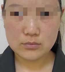 -Yestar 嘉兴艺星医疗美容医院