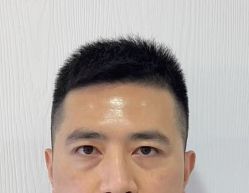 -天津健丽·去眼袋医疗美容机构