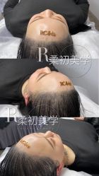 -RC半永久纹眉纹发际线
