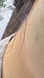 -广州美莱医疗美容医院