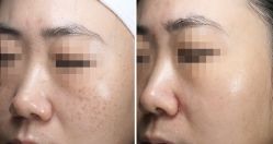 -深圳芙必优医疗美容·抗衰中心