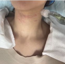 -深圳米兰柏羽医疗美容医院