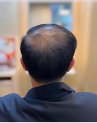 点击看大图 -LAQUEEN 时尚健康假发