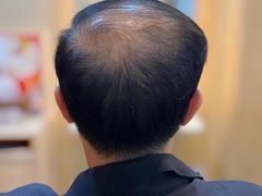 -LAQUEEN 时尚健康假发(万象城总店)