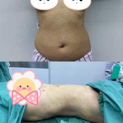 体验前-上海漾颜医疗美容