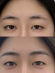 点击看大图 -DR·Z 科技护肤中心