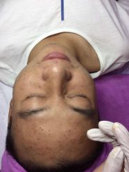 -瑶芳·痘院士专业祛痘·皮肤管理