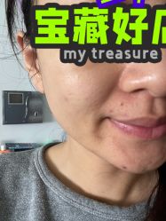 体验后-纯粹医美