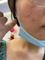 体验后-杭州奥拉克医疗美容门诊部
