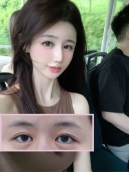 点击看大图 -丰联丽格医疗美容·联合丽格眼整形中心