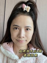-广州美莱医疗美容医院