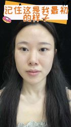 -素美医疗美容·西南眼鼻整形·修复基地