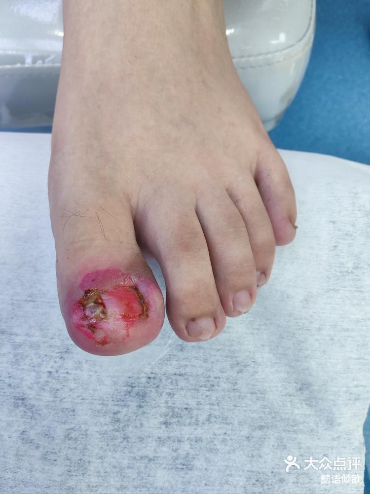 app查看高清大图 懿语倾歆 6月2日 23:32 关注 修脚