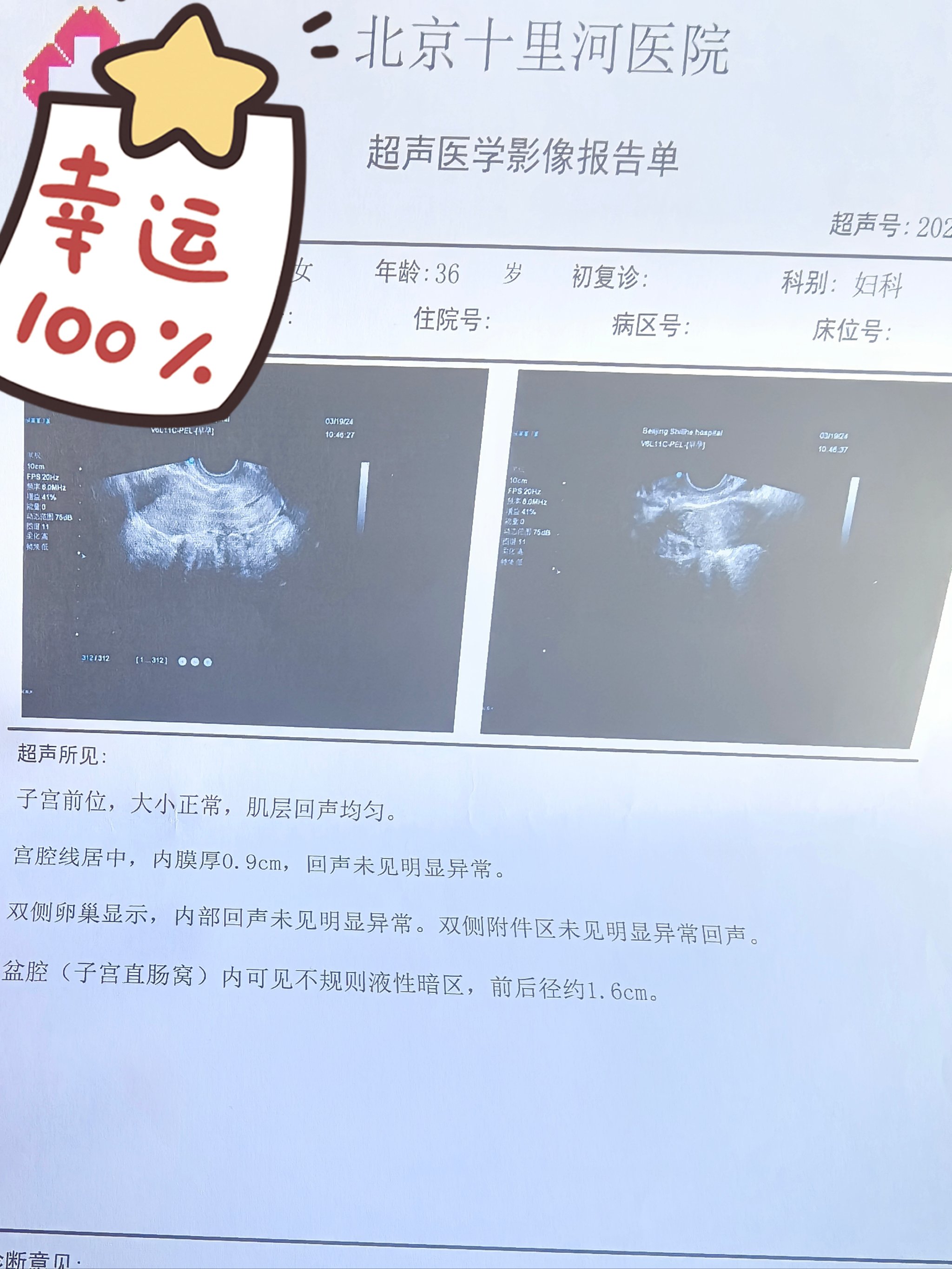 怀孕初期出血颜色表图图片