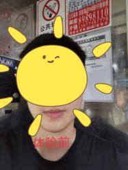 体验前-AIST爱思特医疗美容医院