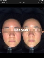 体验前-Deeplus+韩国皮肤管理한국피부관리·C:Lab肌肤实验室