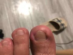 -世龙世家灰指甲鸡眼脚气甲沟炎跖疣护理(通州店)