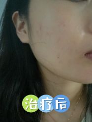 体验后-Yestar 嘉兴艺星医疗美容医院