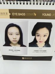 -天津健丽·去眼袋医疗美容机构