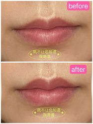 点击看大图 -伊丽莎白医疗美容