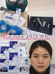 -广州健丽·去眼袋医疗美容机构