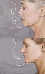 -美肤盾祛痘·问题肌头疗管理中心