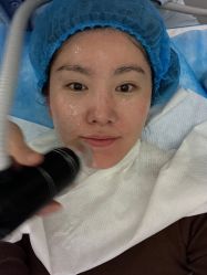 -agge蛋白医美