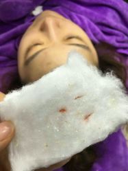 -蕾特恩专业祛痘国际连锁