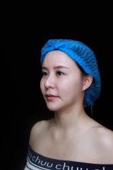 点击看大图 体验前-深圳阳光医疗美容医院·旗舰店