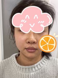 -万州华美紫馨整形美容医院