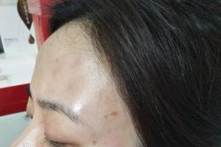 -北京美痣堂古方祛痣斑疣瘊