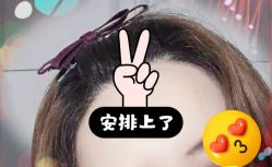 -大麦微针植发全国连锁