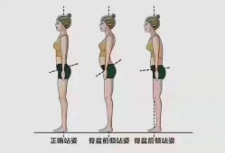 -卓拓普拉提