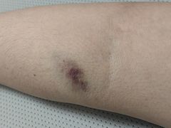 -北京市垂杨柳医院