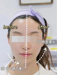 -上海漾颜医疗美容