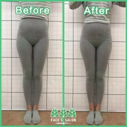 -FACE·日本小颜矫正美容整骨サロン