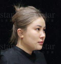 -Yestar艺星整形