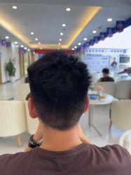 -大麦微针植发全国连锁