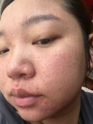 体验后-澳尔颜选医疗美容
