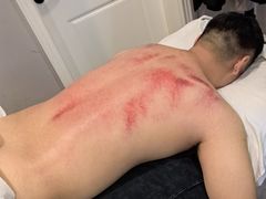 -深蓝盲人推拿·颈肩腰腿疼痛·艾灸调理(清河店)