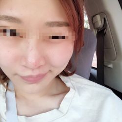 -美丽人生祛斑扁平疣汗管瘤中心