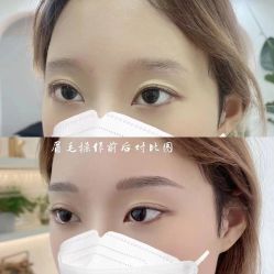 点击看大图 -Verywang半永久纹眉•仪器野生眉