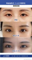 -丰联丽格医疗美容·联合丽格眼整形中心