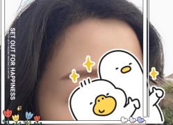 -大麦微针植发全国连锁