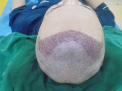 -熙朵美学植发·连锁品牌