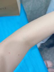 点击看大图 体验后-弘美医美·艾维岚童颜抗衰中心