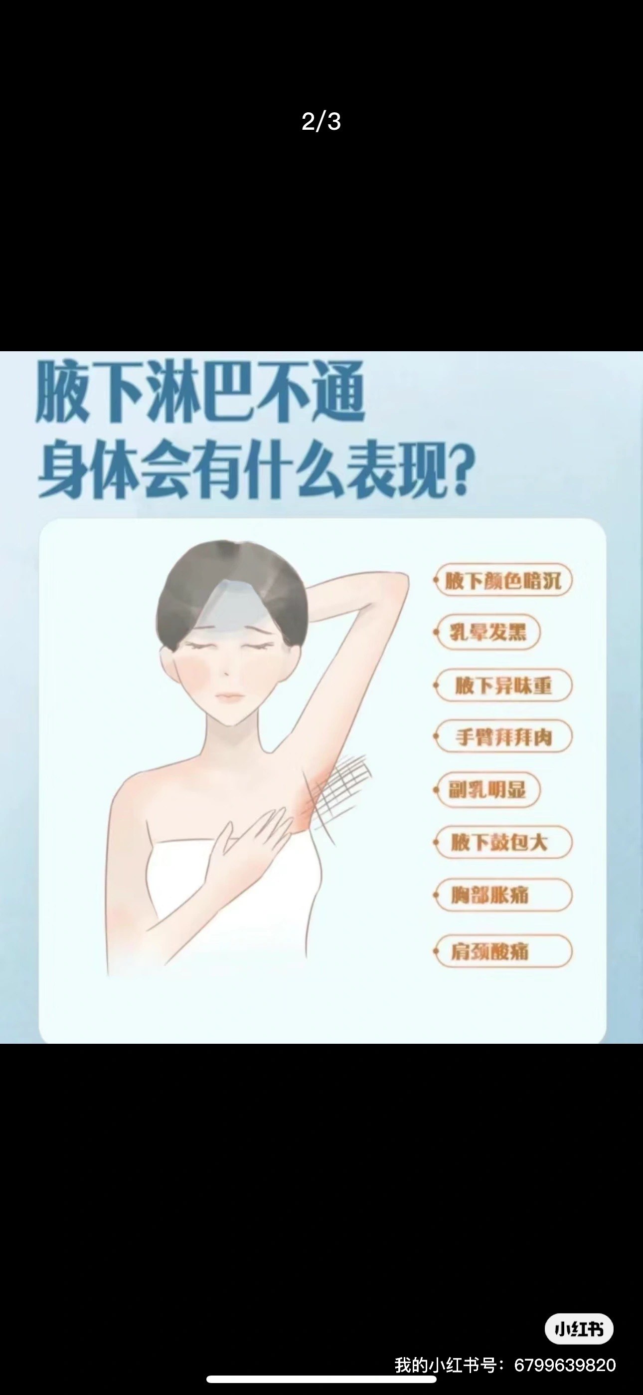 乳腺淋巴位置图片大全图片