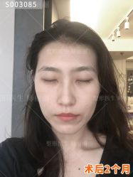 -丰联丽格医疗美容·联合丽格眼整形中心